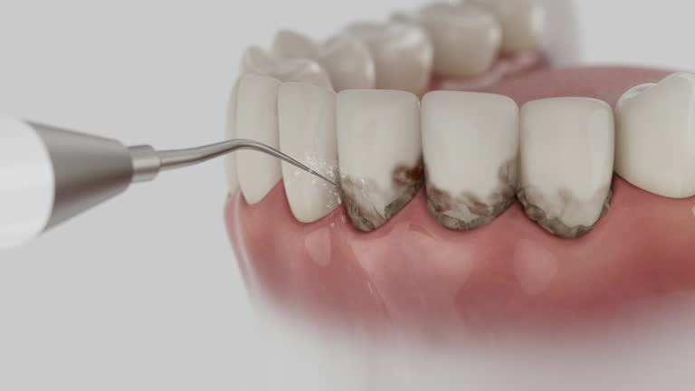 Trusted Invisalign Clear Aligners service in Trenton, GA - Dentist Open Now